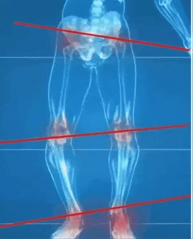 Plantillas ortopedicas en Gel