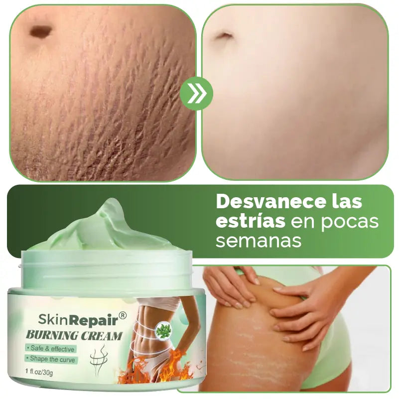 CREMA ANTIESTRÍAS SKINREPAIR